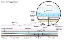 Heavy spring snow falls (A) and begins to melt, forming a pond on top of the membrane (B). Temperatures drop and ice forms (C), adhering to the roof at the edges of the pond (D) and trapping the water below. Ice continues to form, creating downward pressure against the membrane (E). Water pushes the membrane down around an overlooked screw, opening a hole and letting pressurized water flow into the ceiling (F).