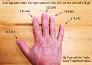 compensation by workers comp for the loss of digits